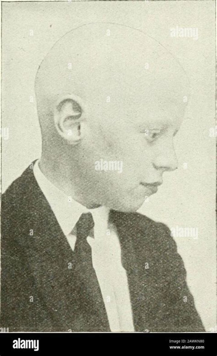 Totally devoid of hair